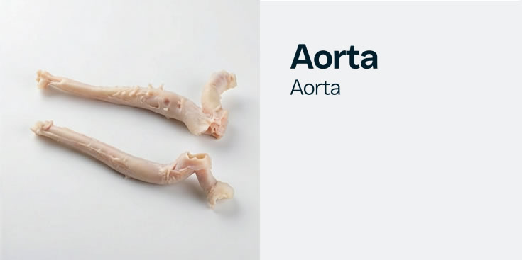 aorta